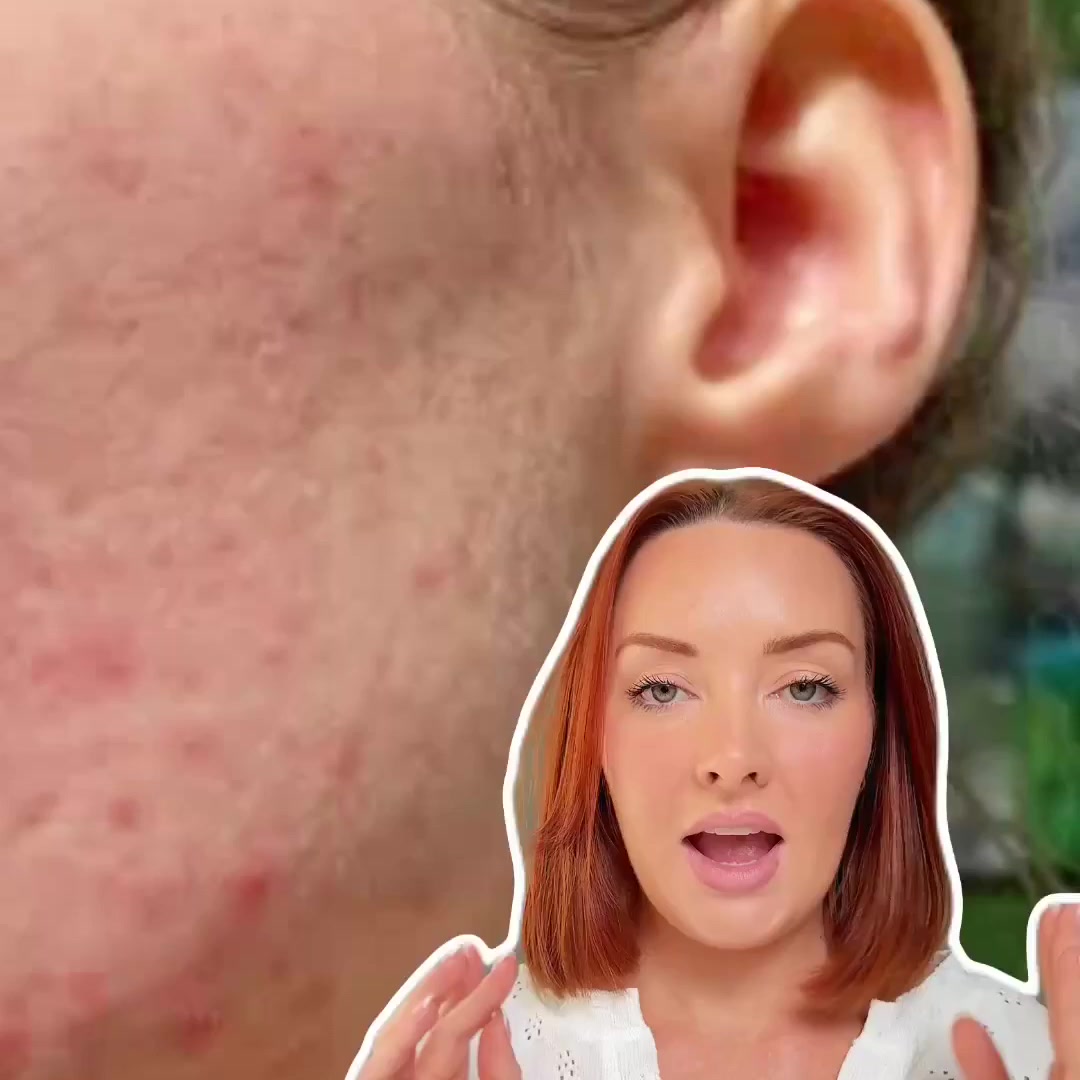 SkinB5 Facebook ad