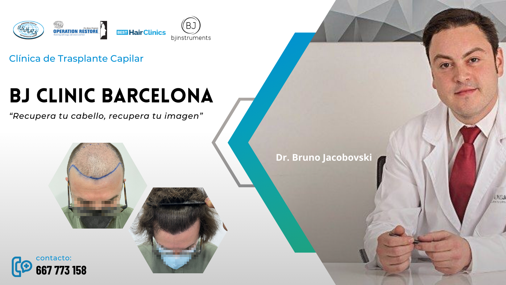 BJ Clinic Barcelona Facebook ad: Bienvenidos a BJ CLINIC BARCELONA, tu centro líder…