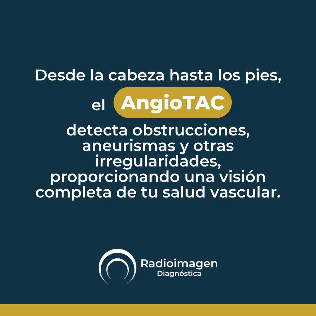 Radioimagen Diagnóstica Facebook ad: Esta avanzada técnica de imagenología combina la potencia…