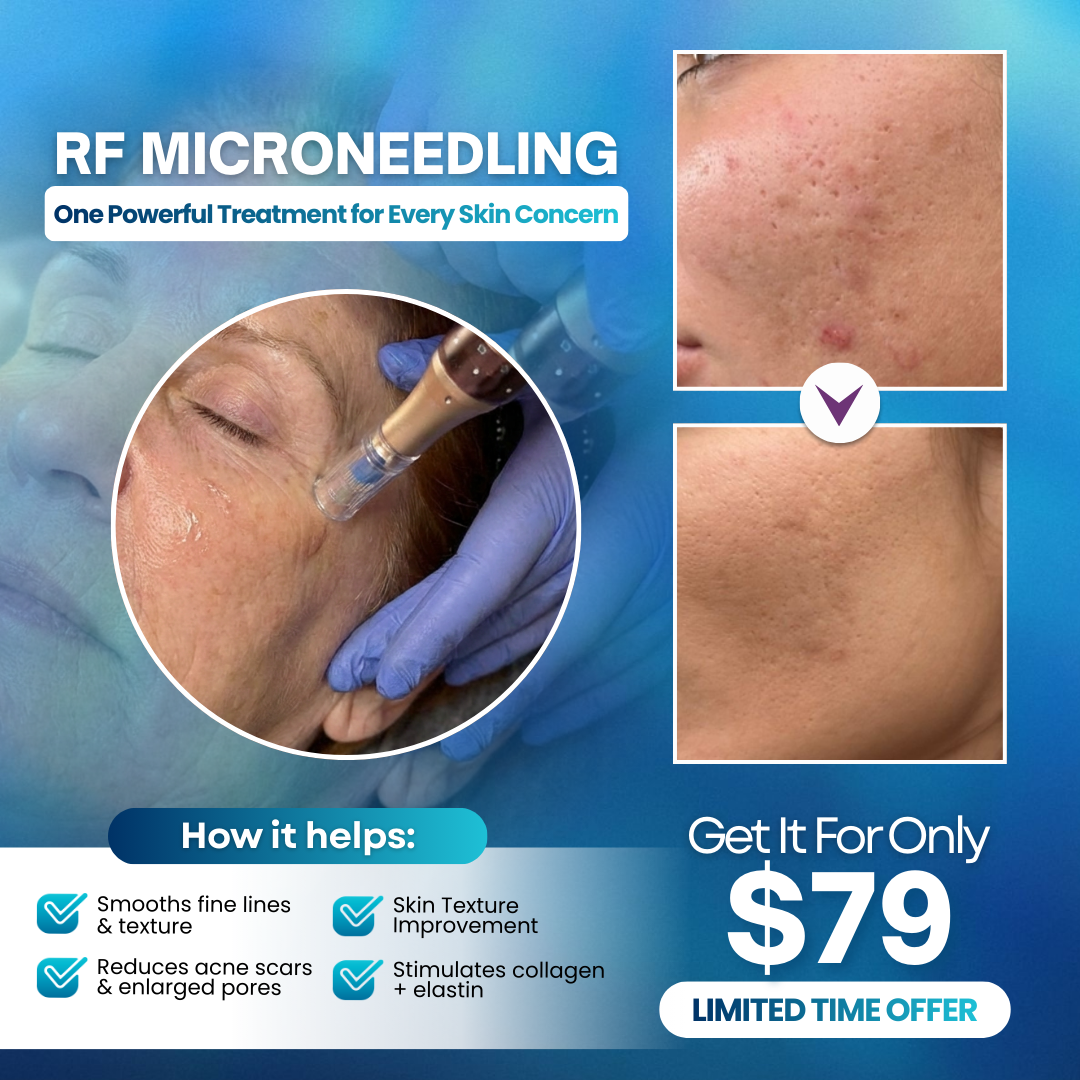 I Love Skin Treatments Facebook ad