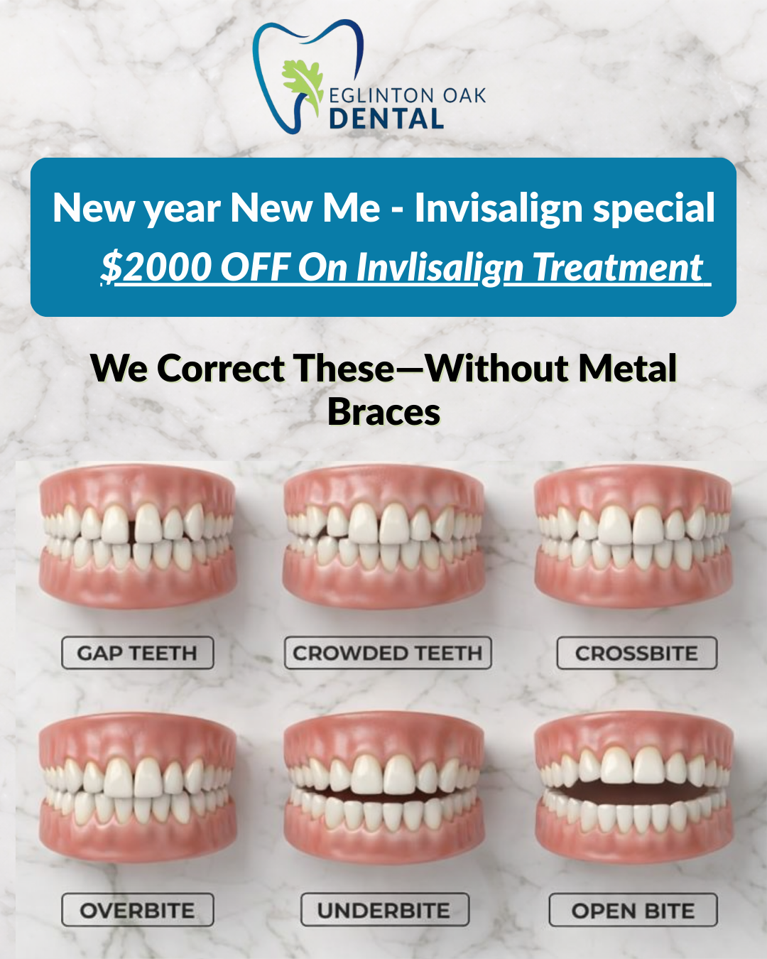 Eglinton Oak Dental Facebook ad: Imagine Smiling Without Thinking Twice.