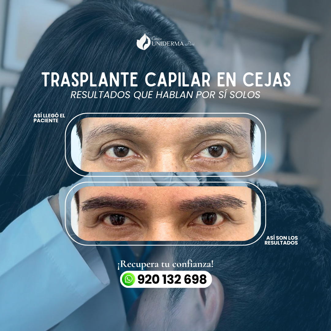 Uniderma Capilar Facebook ad: Resultados que hablan por sí solos