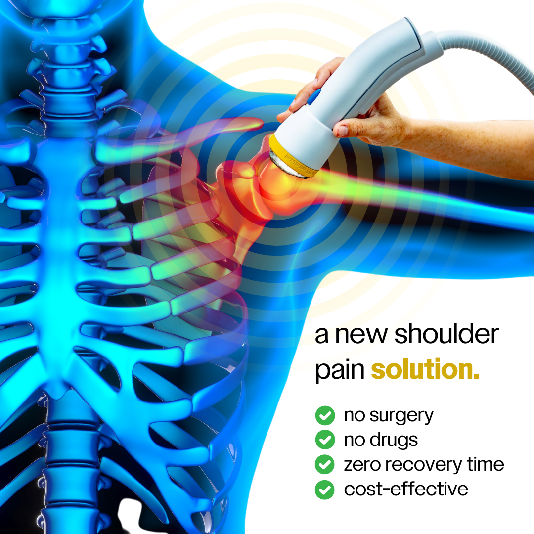 Source Chiropractic & Wellness, Dr. John Cheney Facebook ad: $39 Pain Treatment Special