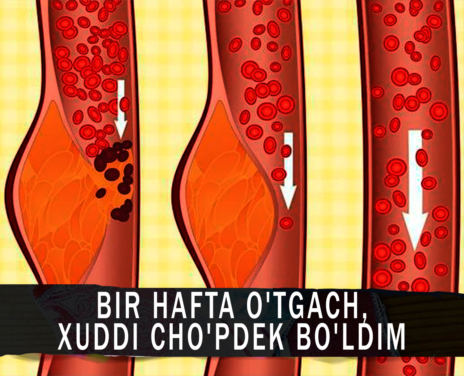 Харакенско Facebook ad: Bir hafta o'tgach, xuddi cho'pdek bo'ldim