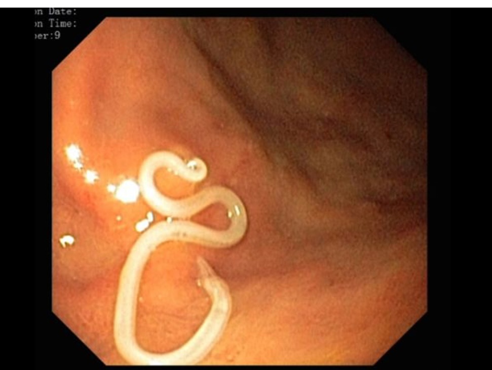 Michael Stanton, MD Facebook ad
