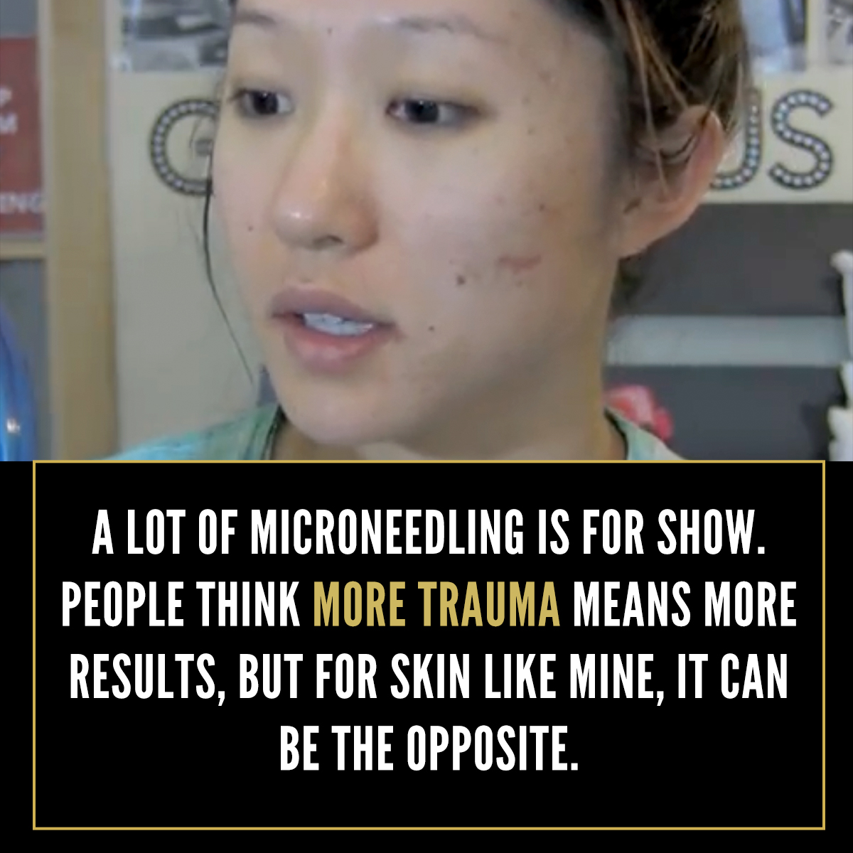 Banish Acne Scars Facebook ad