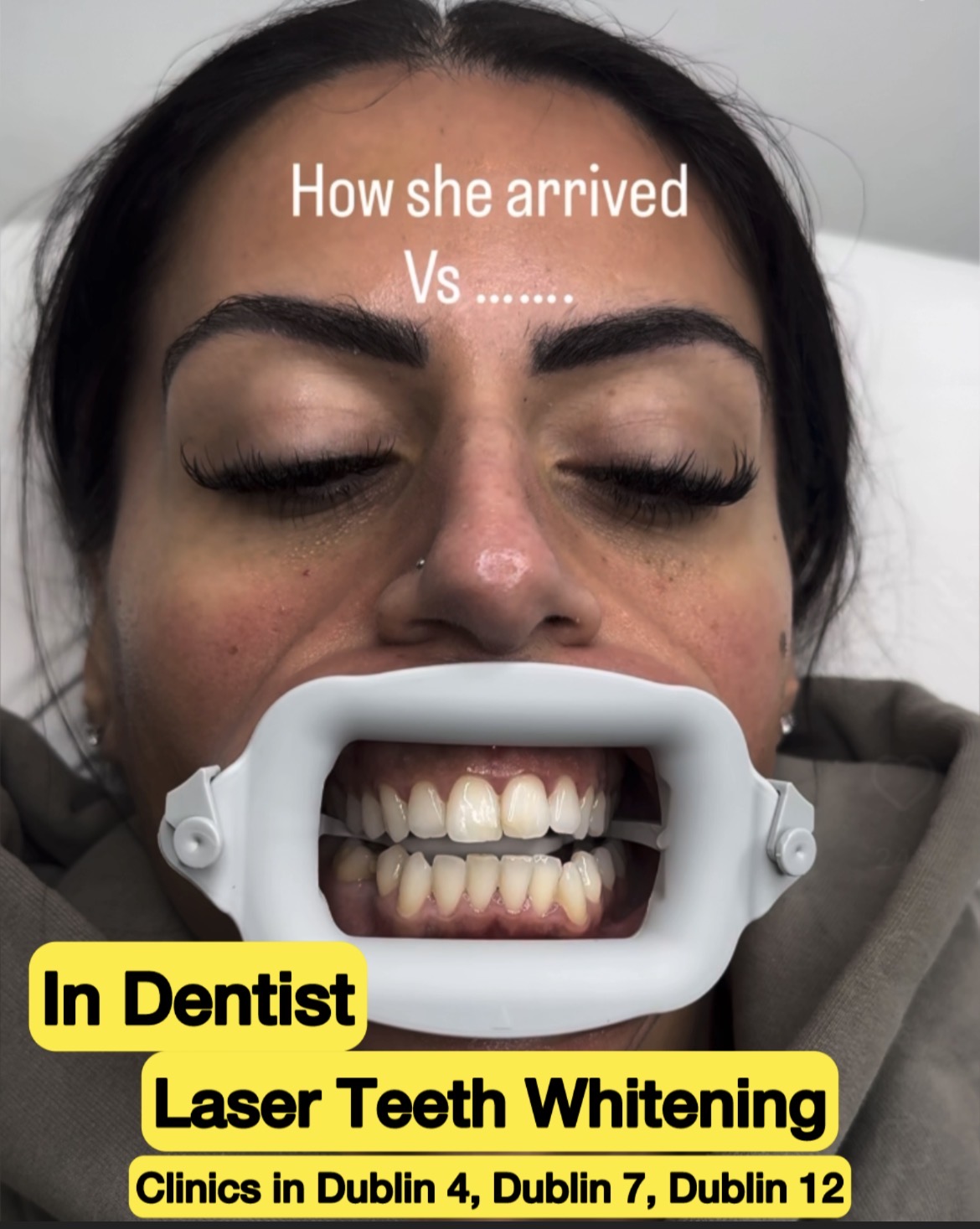White Smile Facebook ad