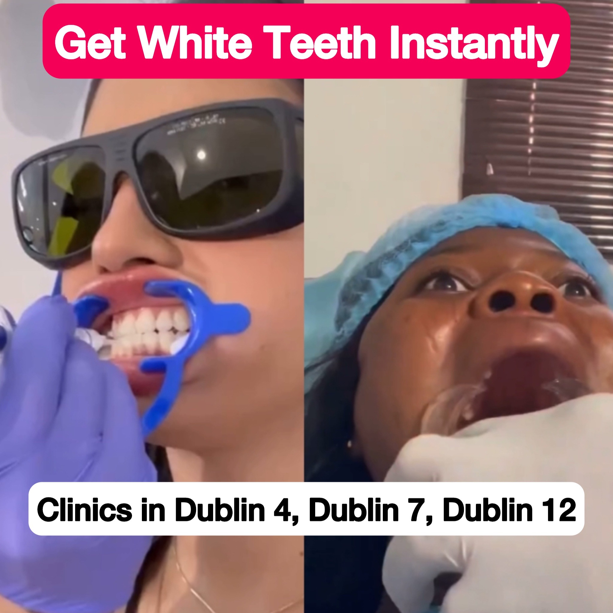White Smile Facebook ad