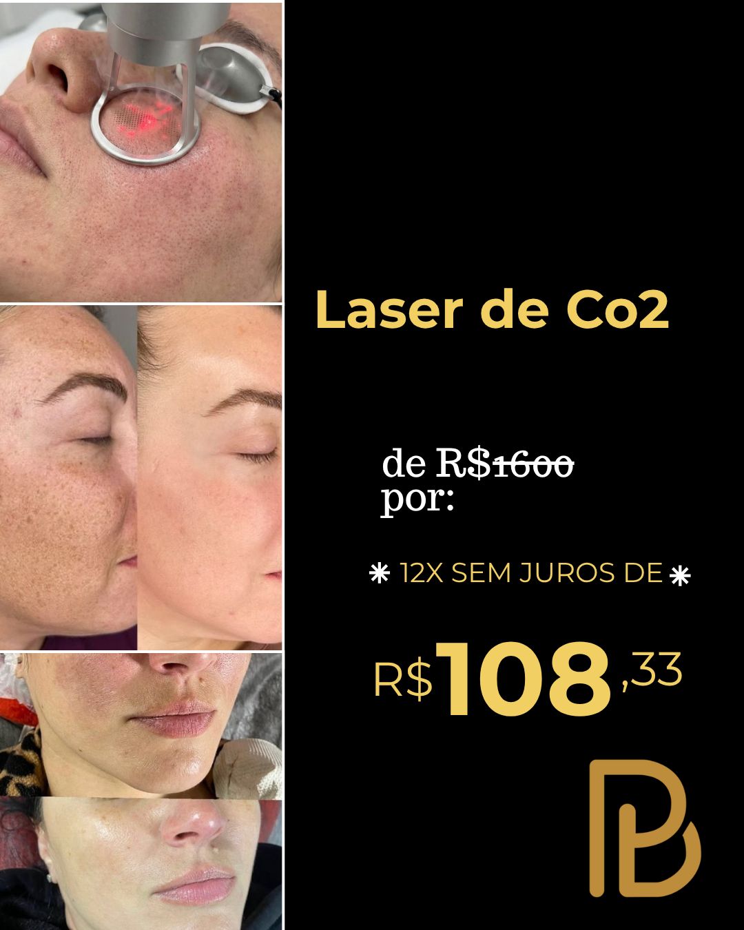 Botopremium' Facebook ad: Laser CO2