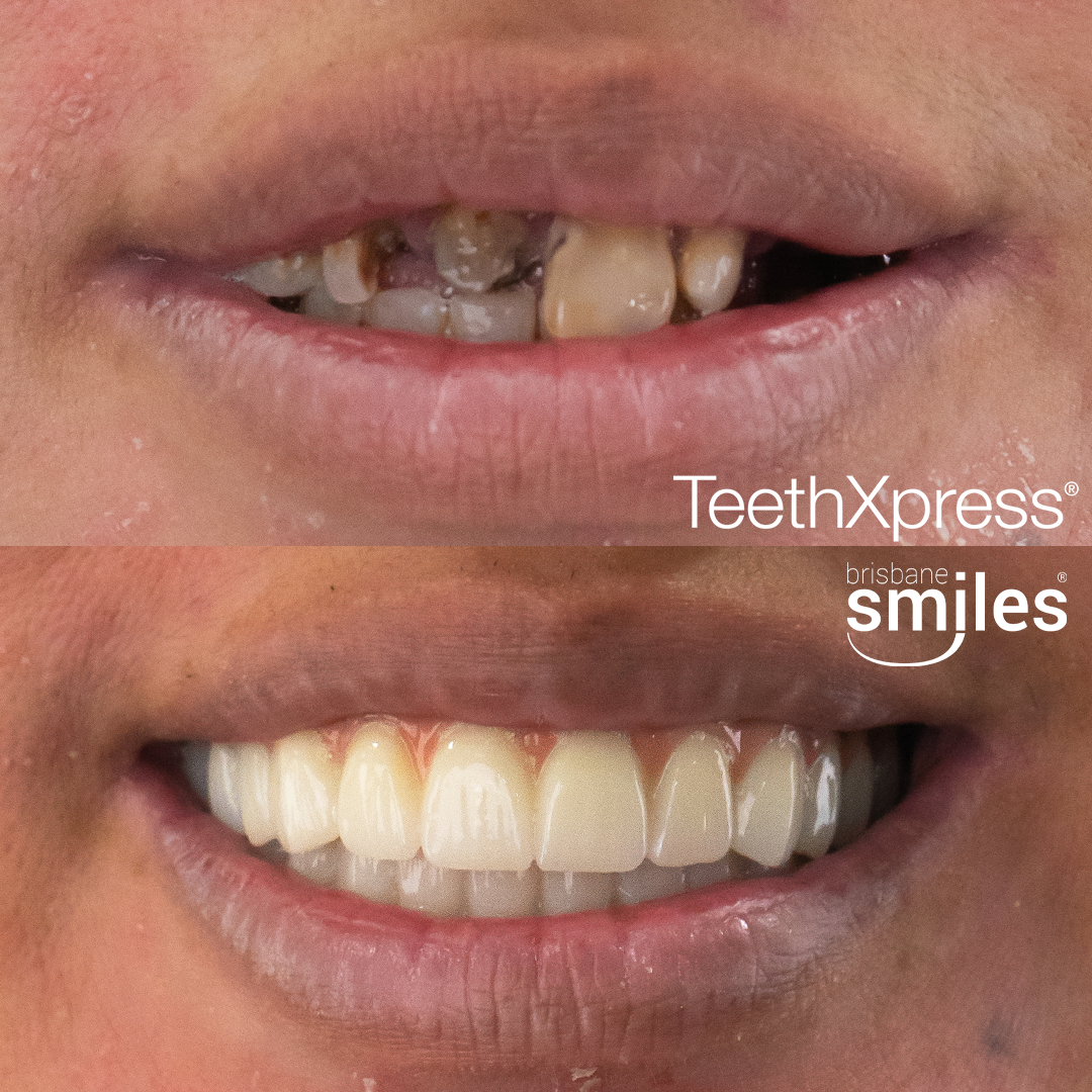 Brisbane Smiles Facebook ad