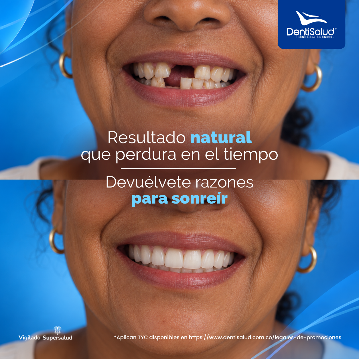 Dentisalud Facebook ad: Agenda tu cita ahora.