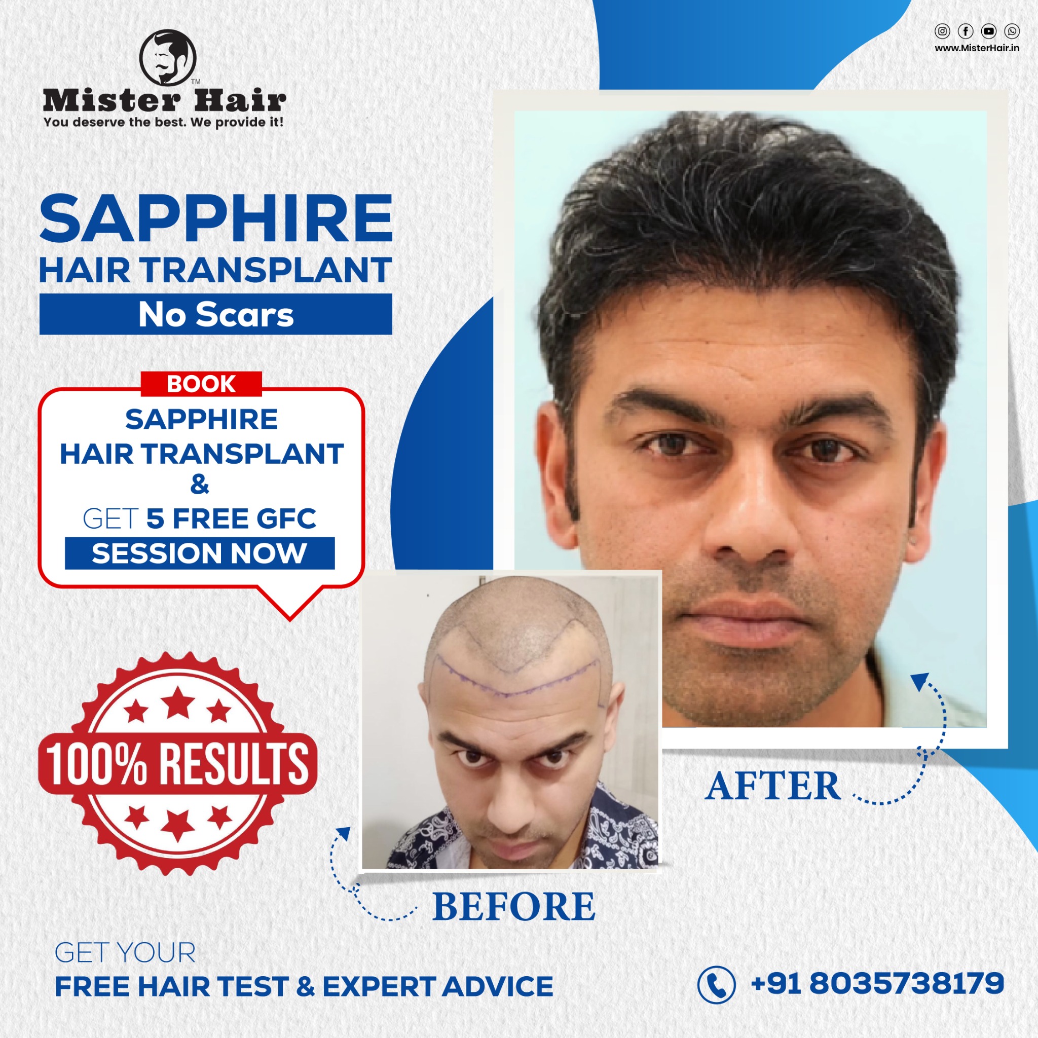 Mister Hair Clinic Facebook ad: Professional doctors. Clear guidance.