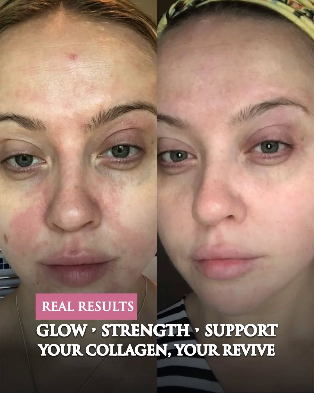 Revive Collagen SG Facebook ad