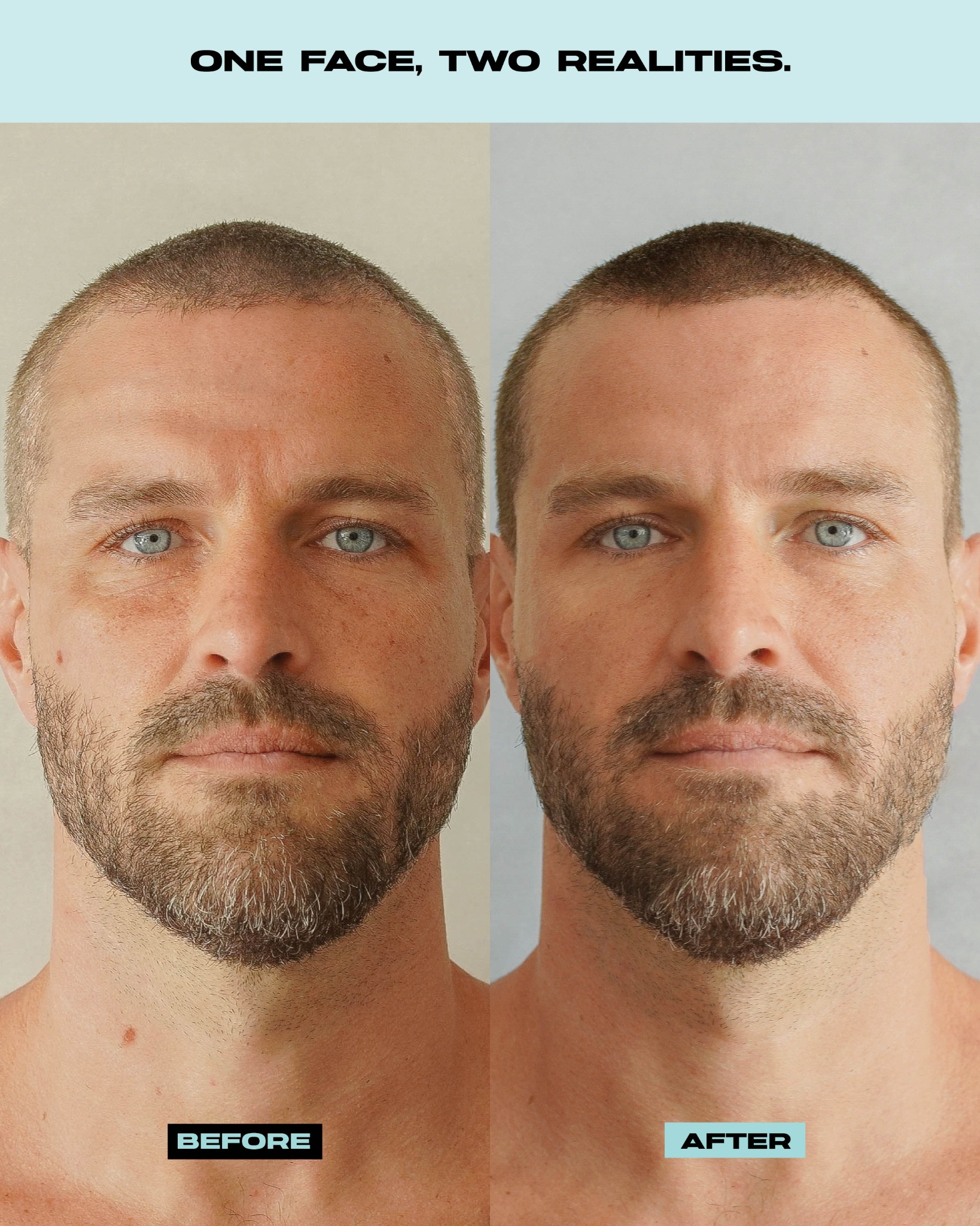 Man Up Skin Facebook ad