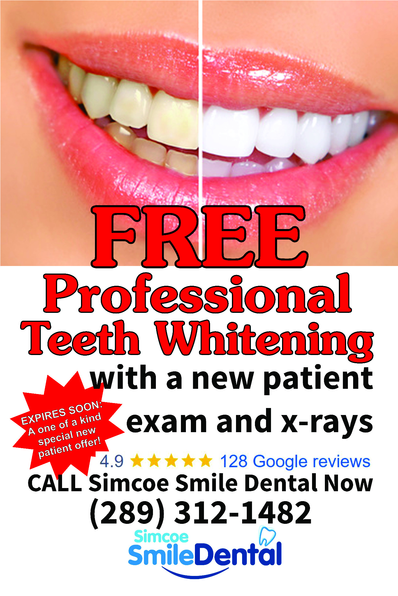 Simcoe Smile Dental Facebook ad: Free teeth whitening for new patients