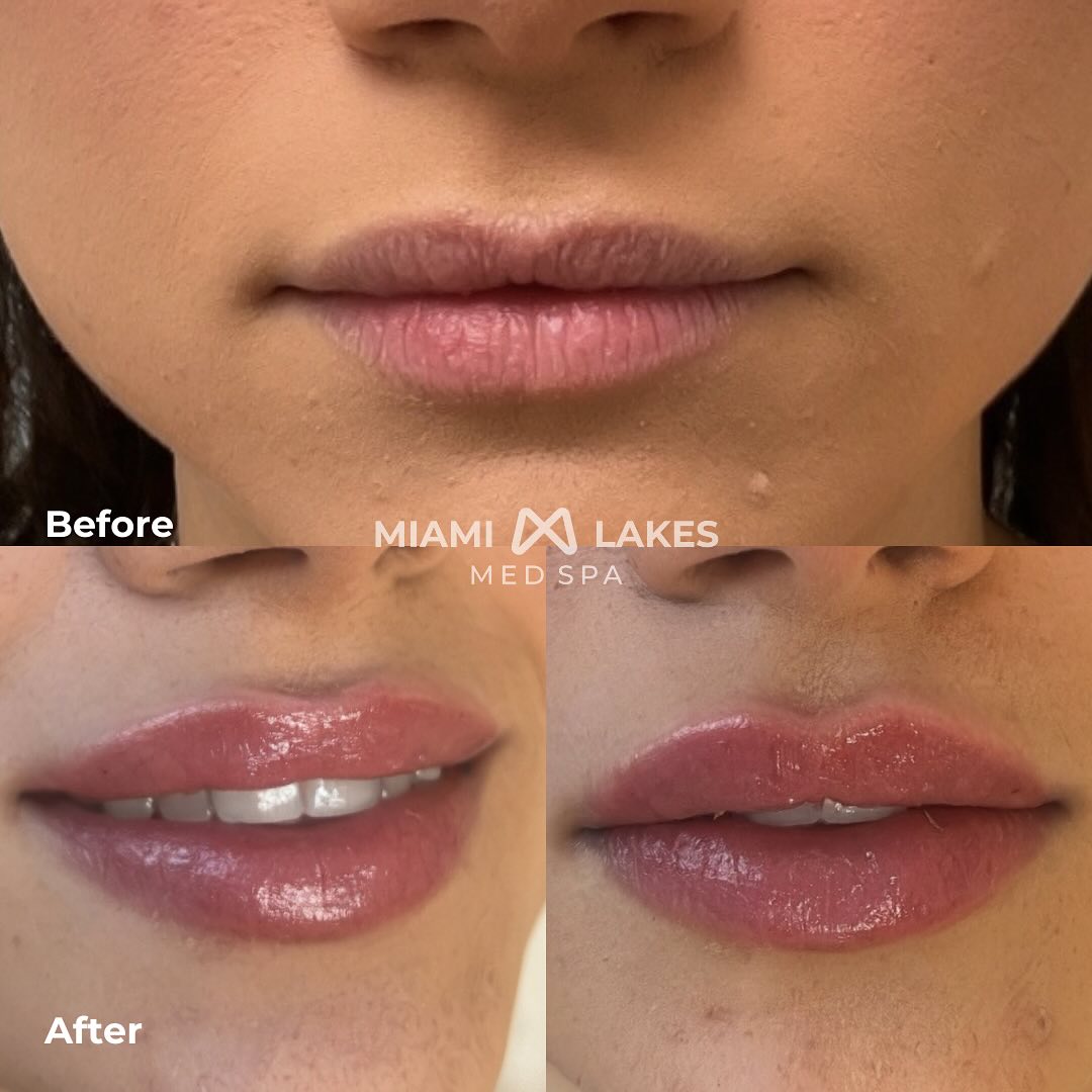 Miami Lakes Med Spa Facebook ad