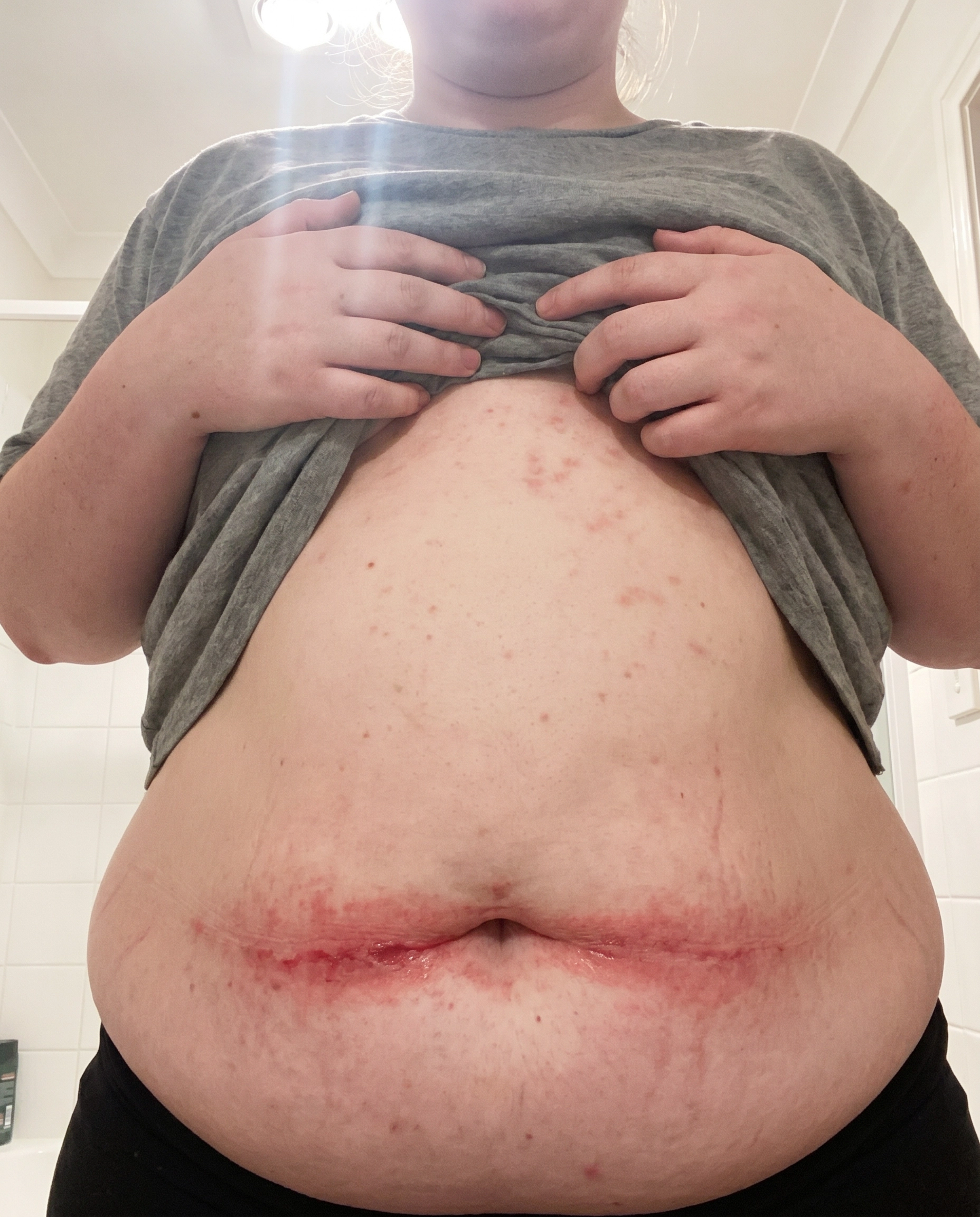 Kim Sanders Facebook ad: If You're on Ozempic and Scratching in Places You NEVER…