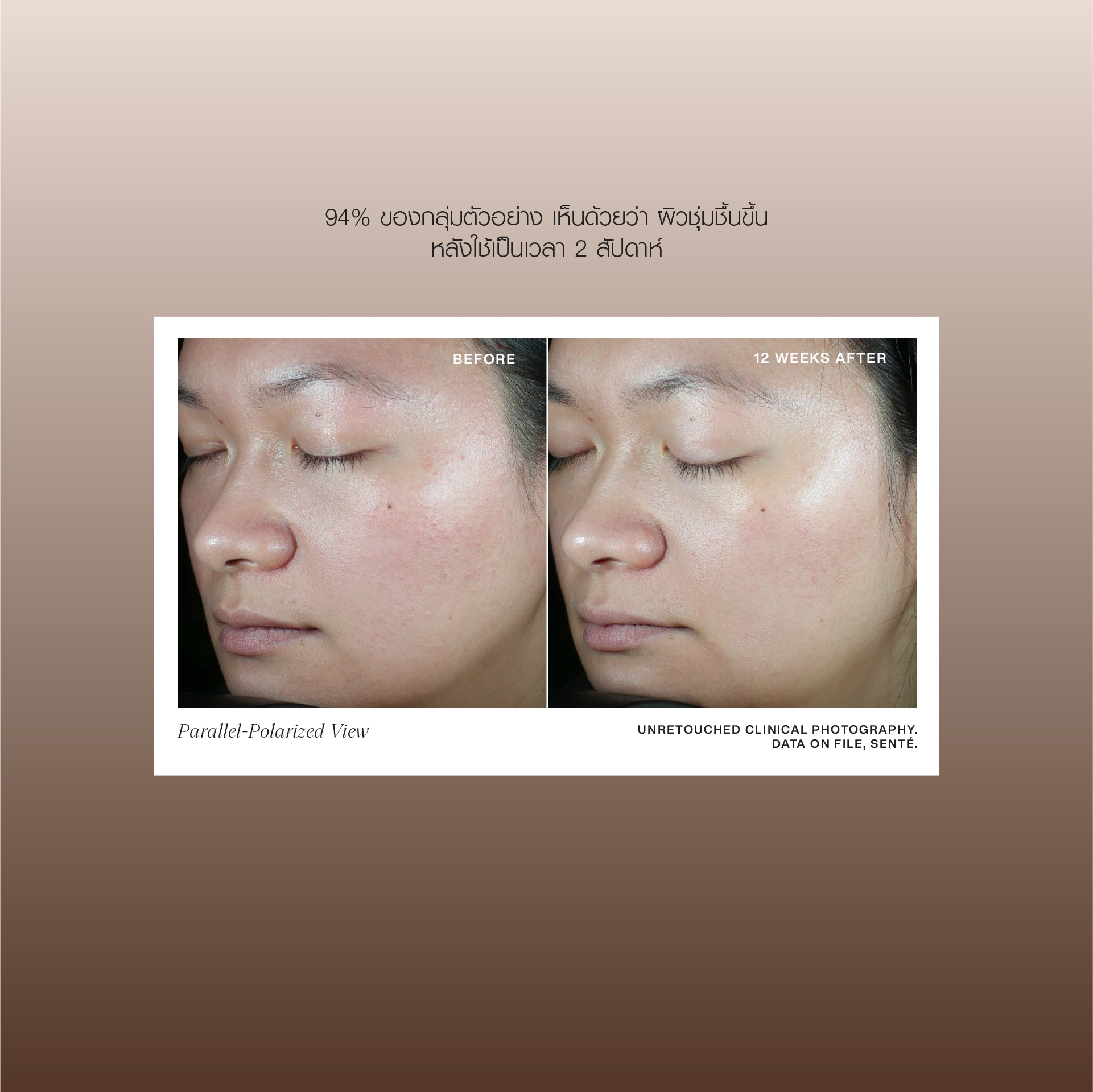 Sente Thailand Facebook ad: ผลิตภัณฑ์ Medical Grade Skincare จากอเมริกา