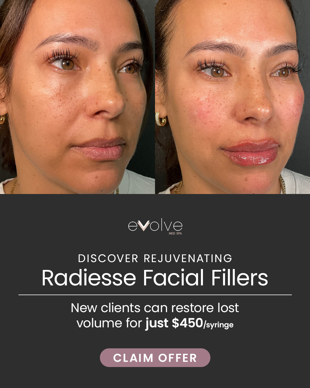 Evolve Med Spa Facebook ad