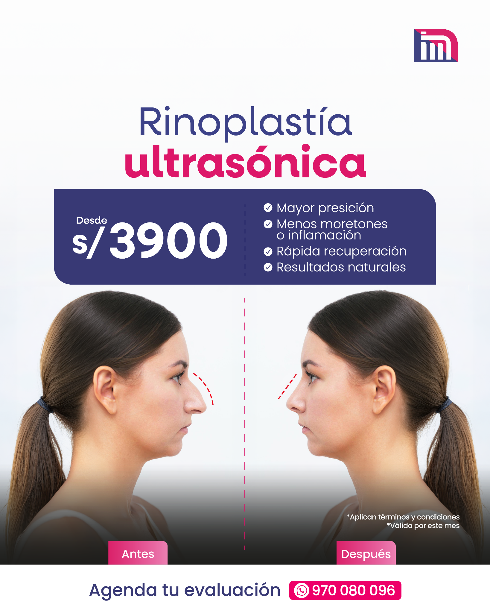 Clínica Monteluz Facebook ad