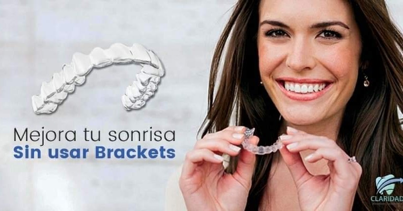 Claridad Alineadores Transparentes Facebook ad