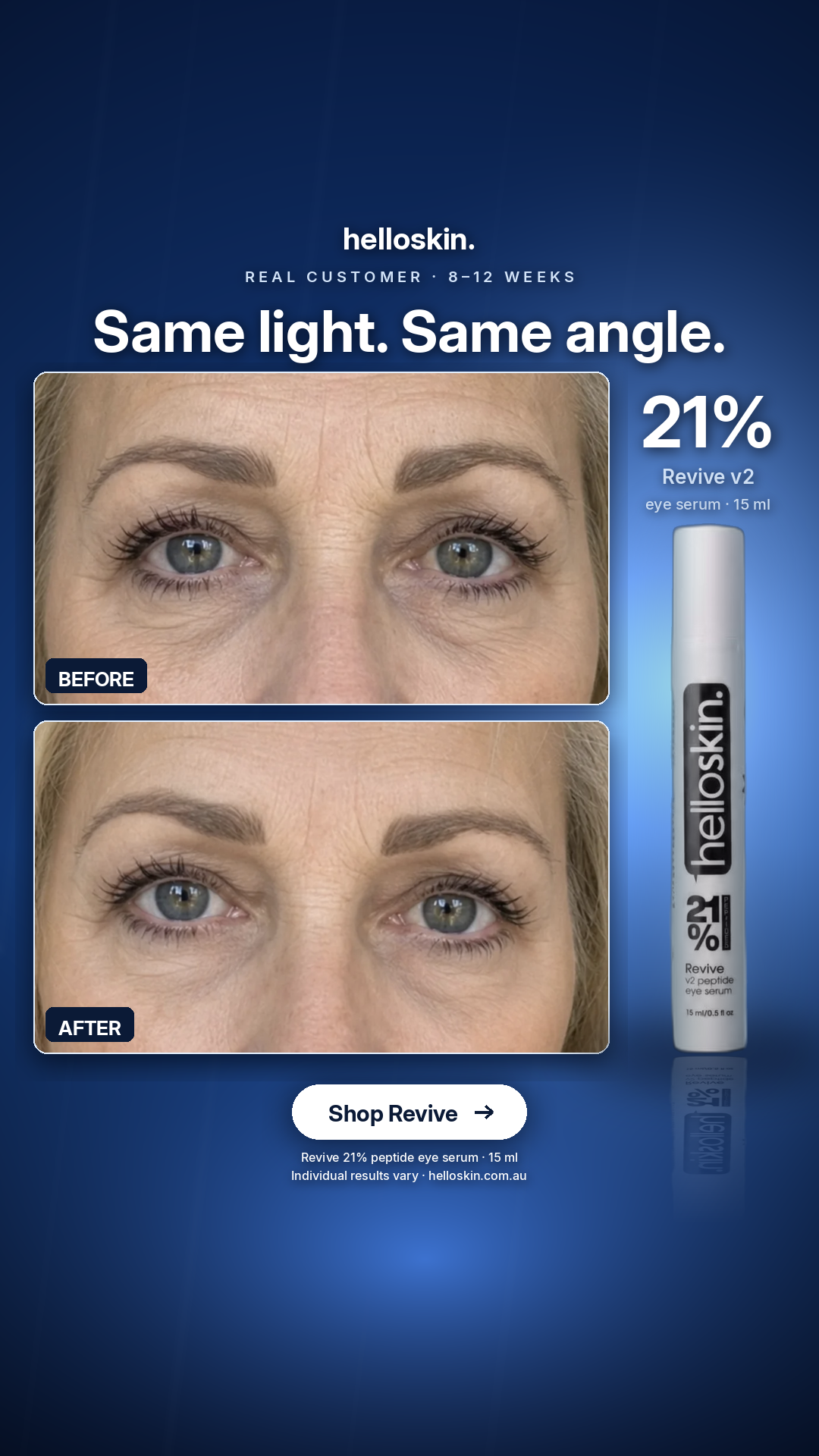 Helloskin Facebook ad: Same light. Same angle.