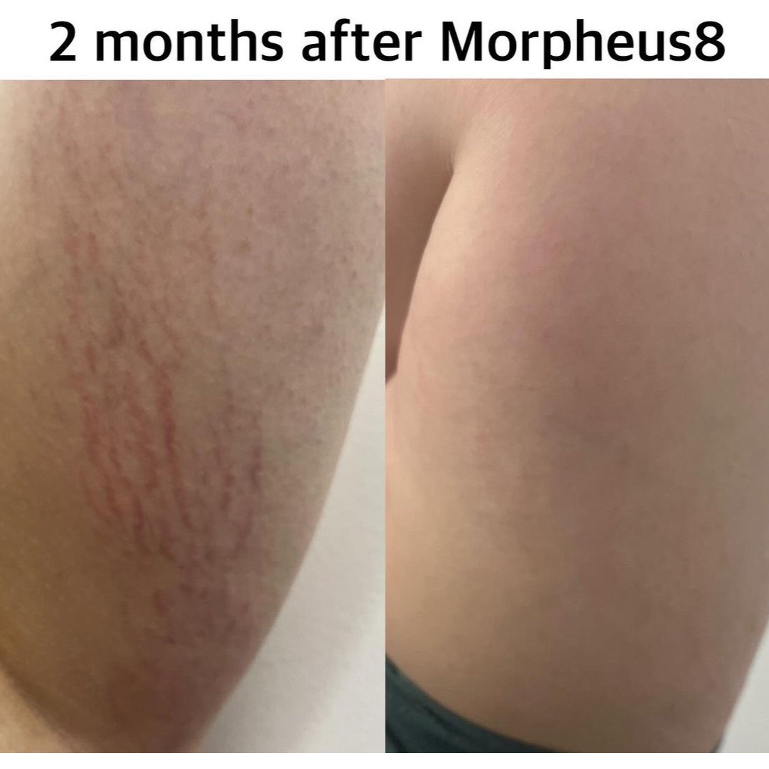 Lebelleaestheticsmiami Facebook ad: Reserve My Fall Transformation!