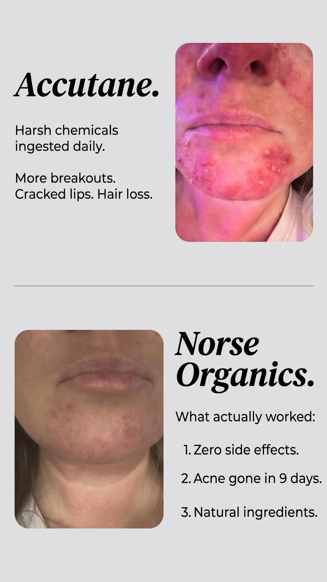 Norse Organics Facebook ad