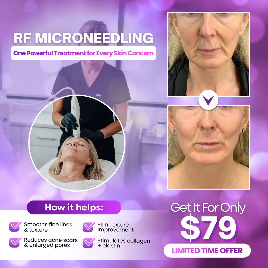 I Love Skin Treatments Facebook ad