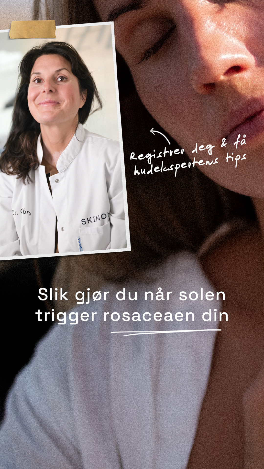 Skinome Facebook ad