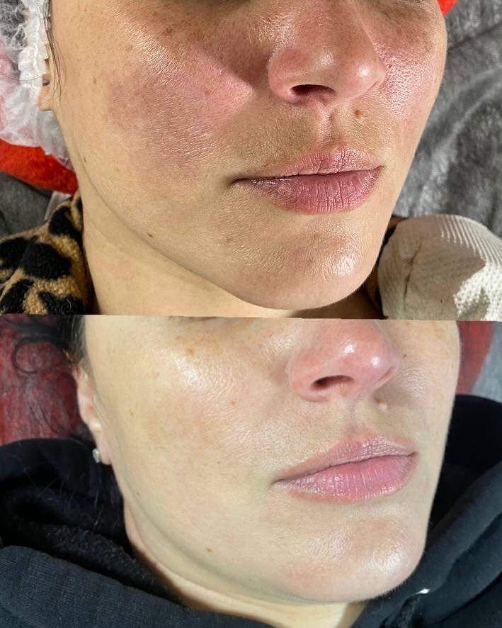 Glow Treatments Facebook ad: Glow Treatments Happy Customers