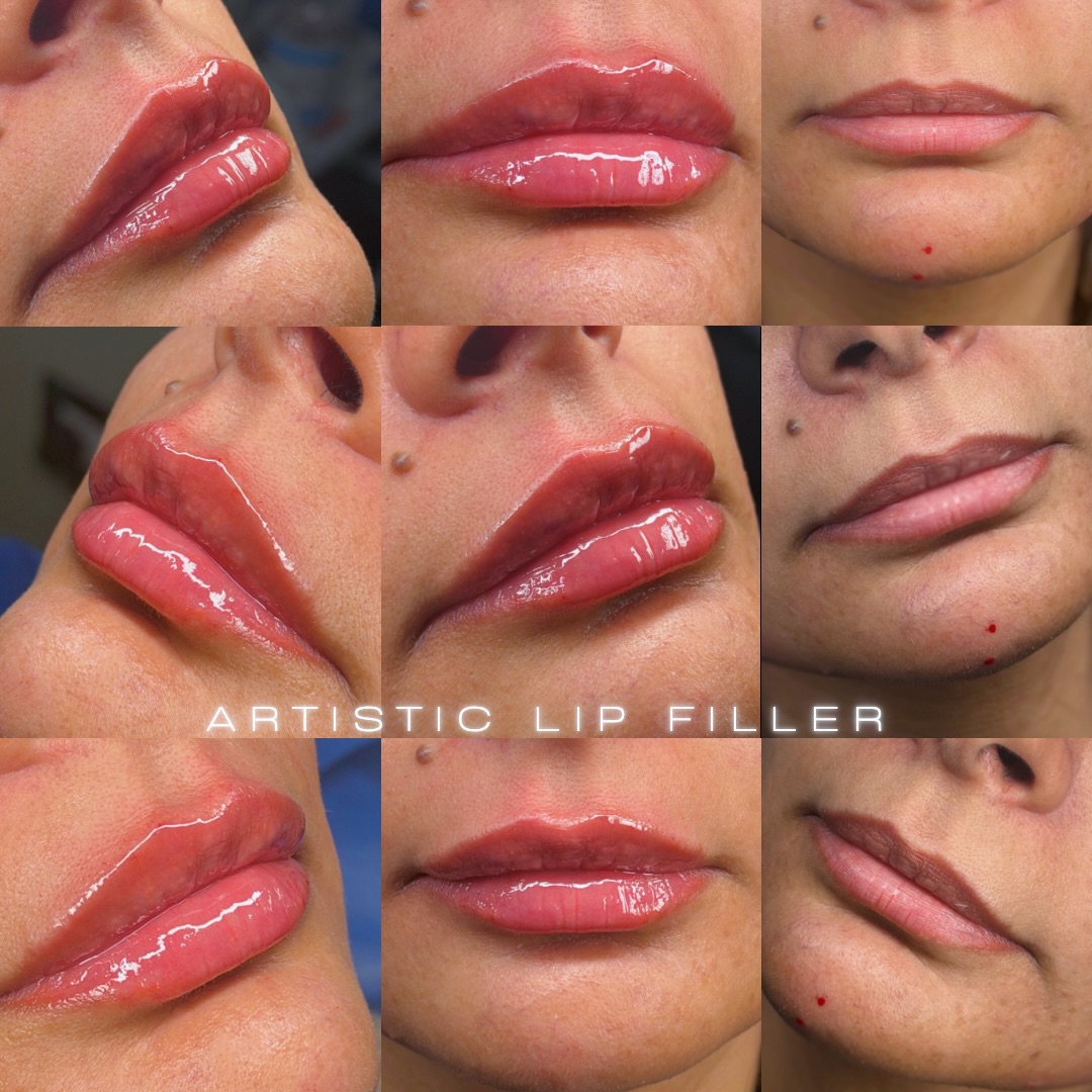 Dr. Ahmed Hewady Facebook ad: STOP asking for someone else’s lips.