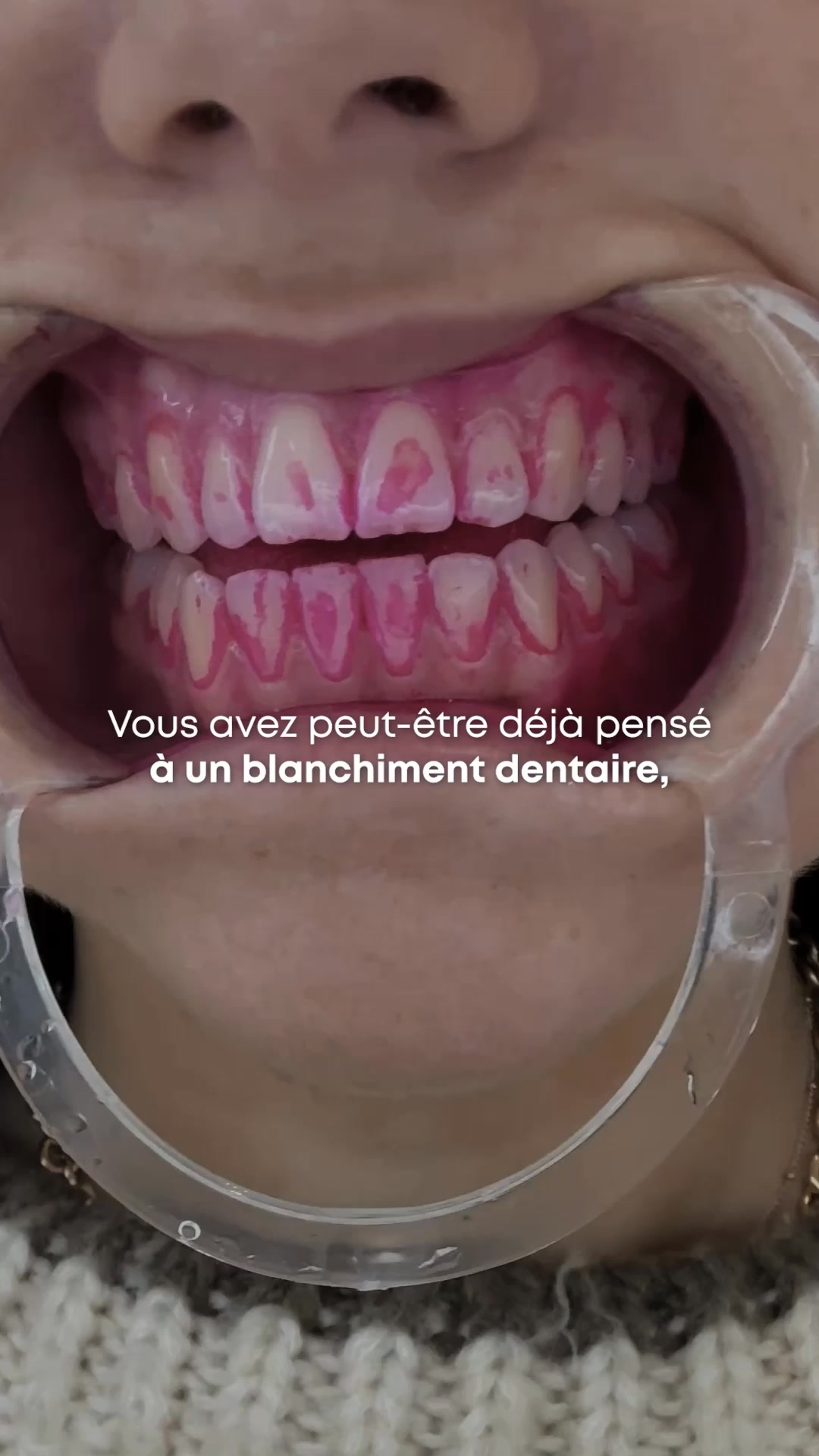 My Variations Facebook ad: +1 000 000 utilisateurs