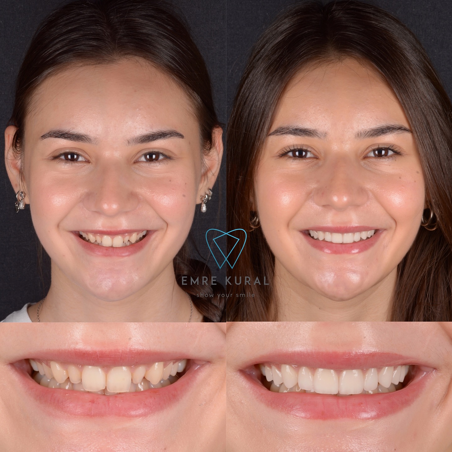 dr.emrekural Facebook ad: Natural Smile Design