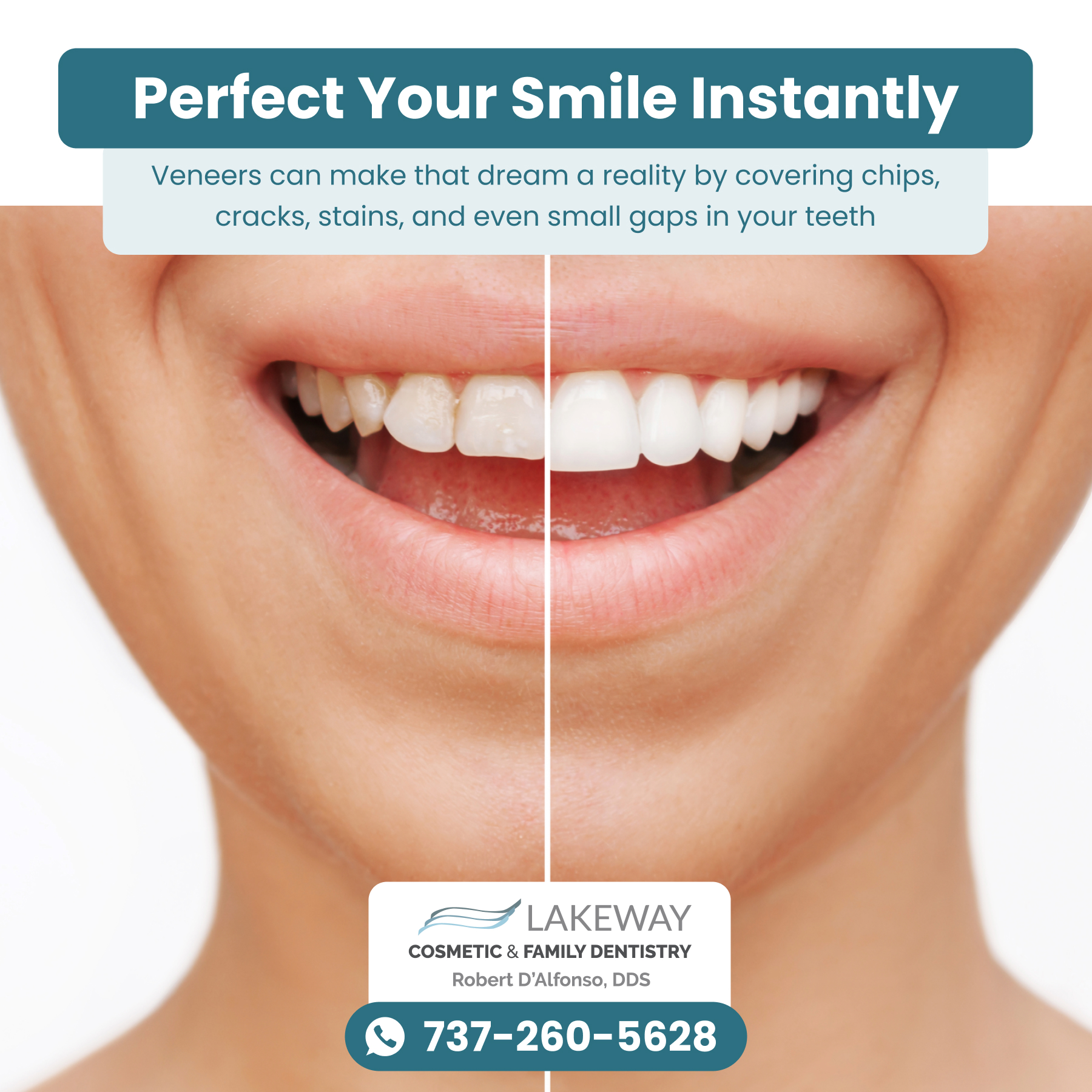 Lakeway Cosmetic Dentistry Facebook ad from Oct 15, 2025