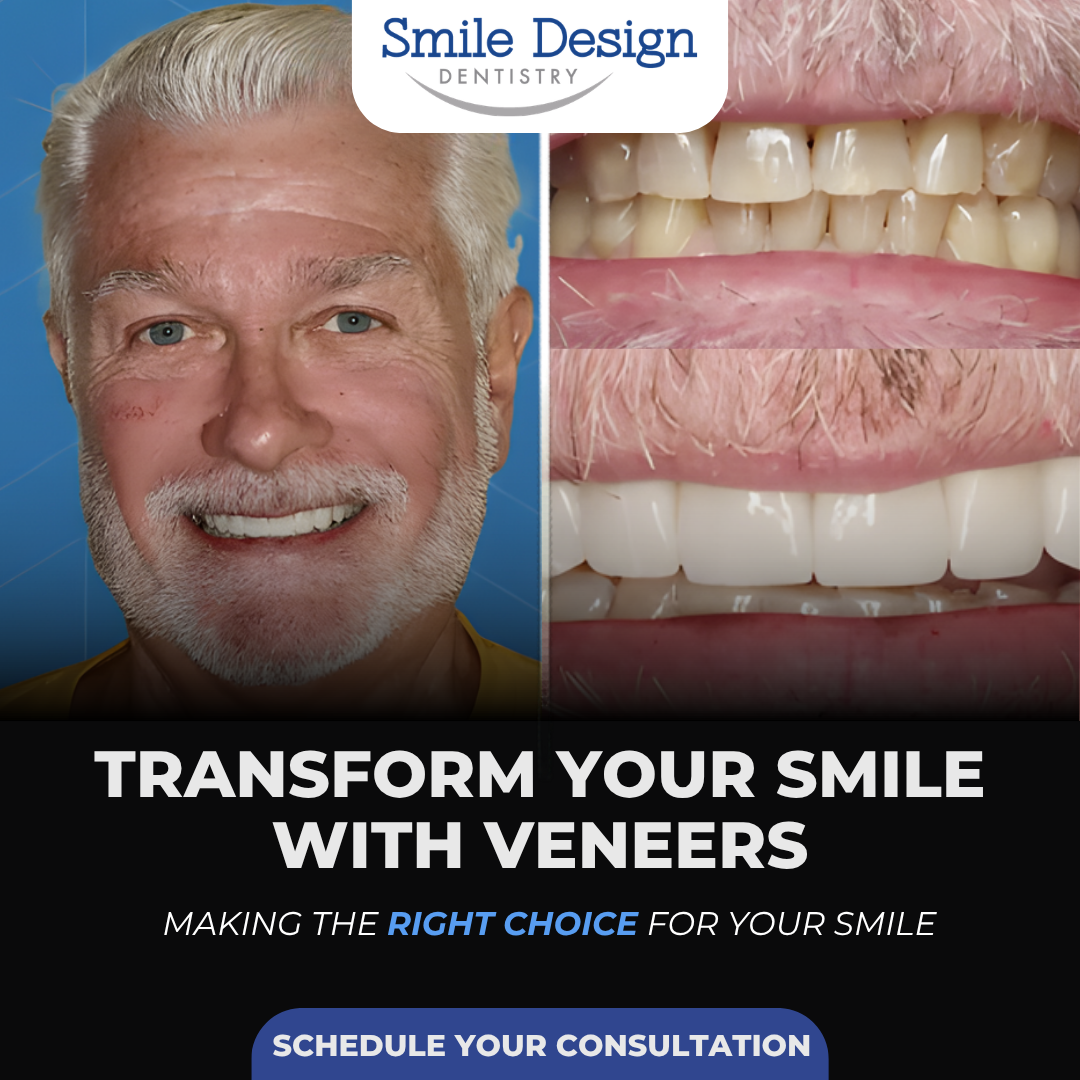Smile Design Dentistry Facebook ad