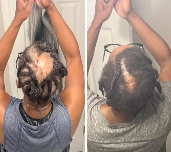 Black Hair Growth Remedy Facebook ad