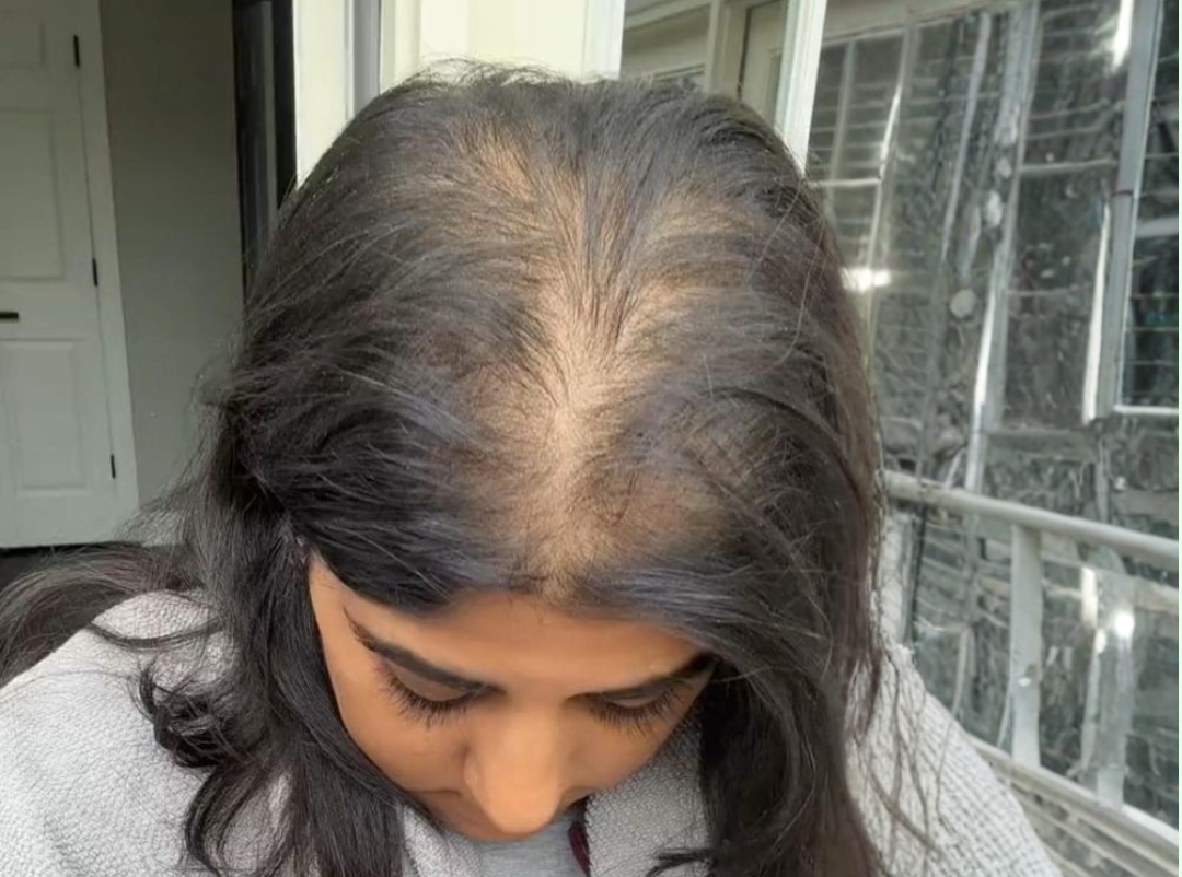 Suhani's Life Facebook ad: माझ्या संपूर्ण प्रवासाची कहाणी वाचा