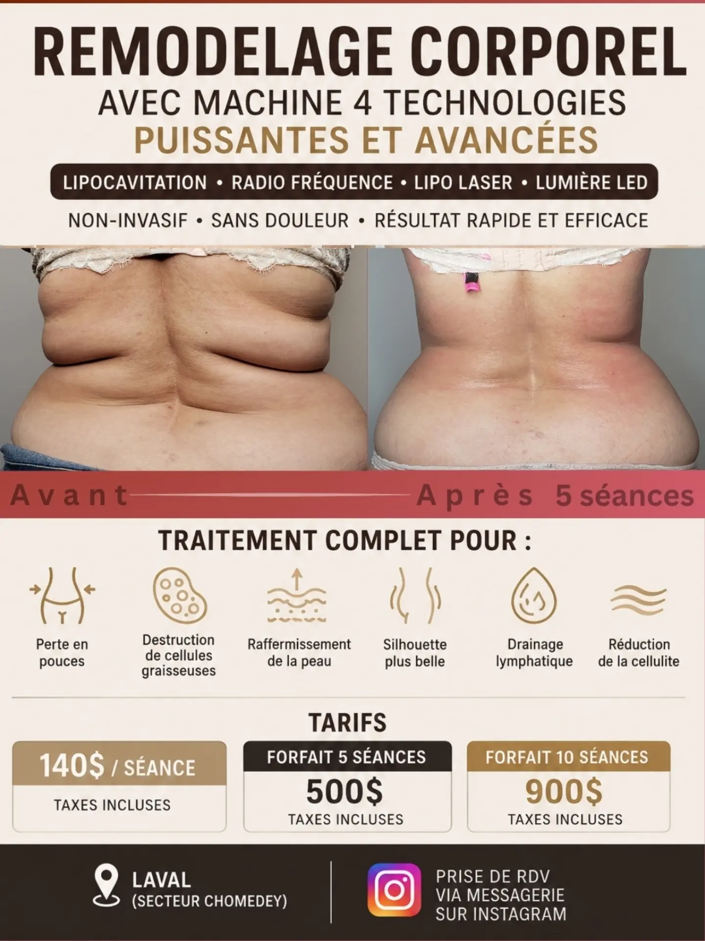 esthetiqueslk Facebook ad: Remodelage Corporel