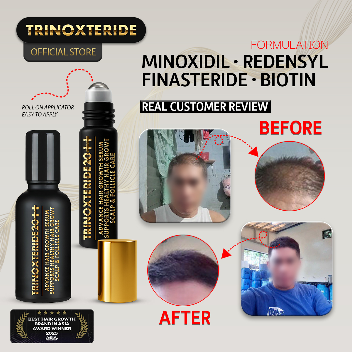 Trinoxteride PH Facebook ad from Apr 13, 2026