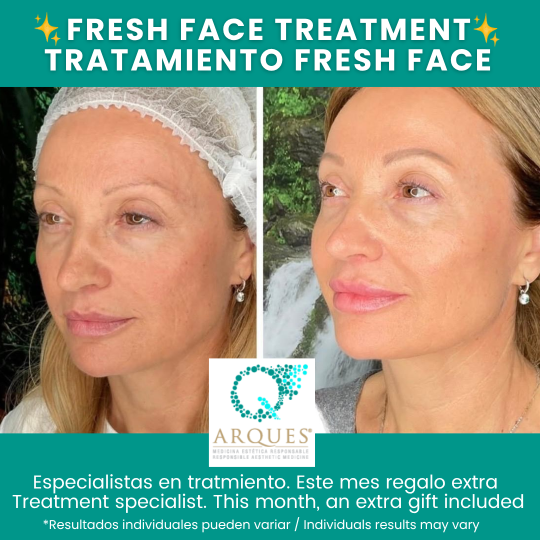 Arques Clinic Marbella Facebook ad: Chatea con nosotros