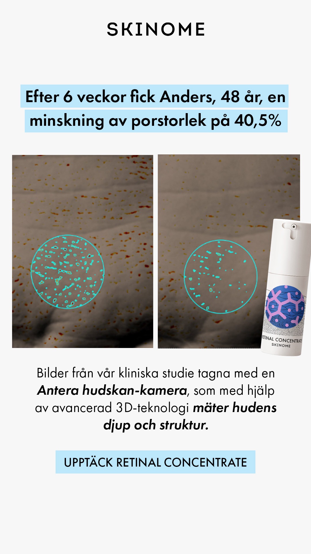 Skinome Facebook ad