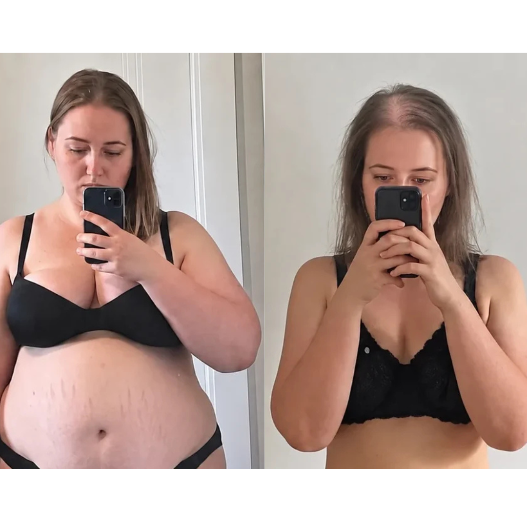 Janine Whitaker Facebook ad: Hair or Weight? I Refused to Choose