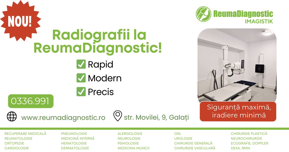 ReumaDiagnostic Facebook ad: ๐๐๐- ๐๐๐๐ข๐จ๐ ๐ซ๐๐๐ข๐ข ๐ฅ๐โฆ