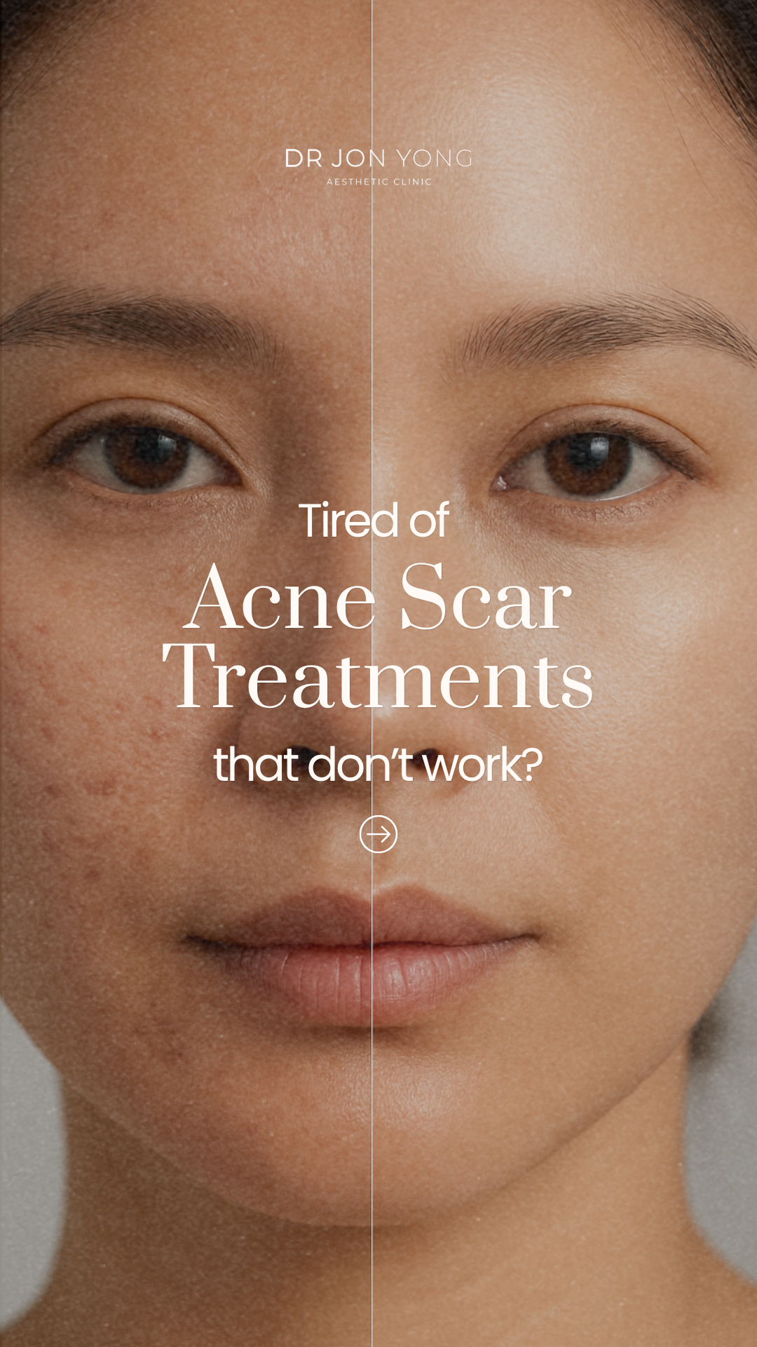 Dr Jon Yong Aesthetic Clinic Facebook ad