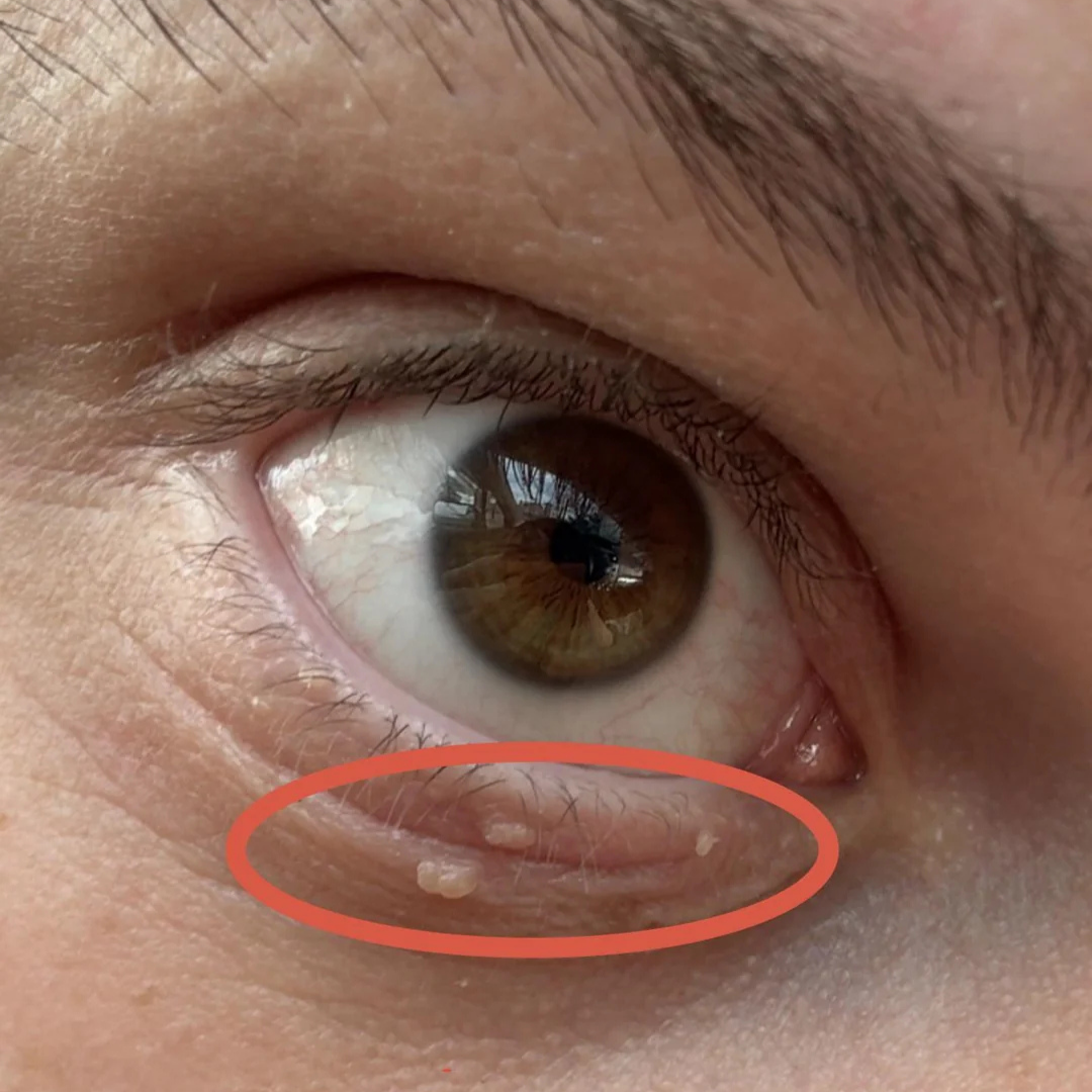 Dr. Elara Wynne Facebook ad: The Skin Tag Warning