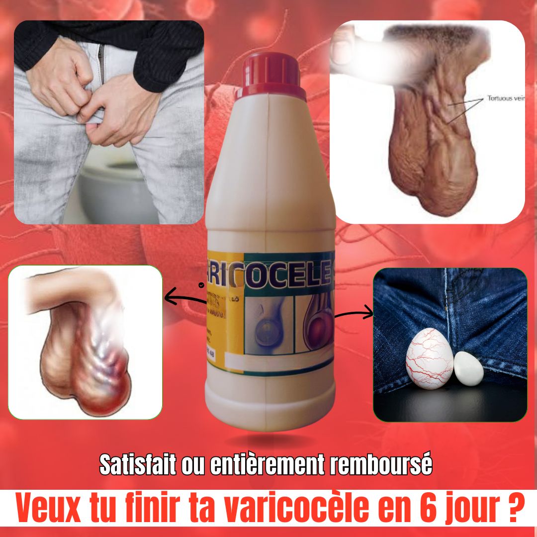 Faso tiim Facebook ad: Veux tu finir ta VARIC0CÈLE en 6 jour