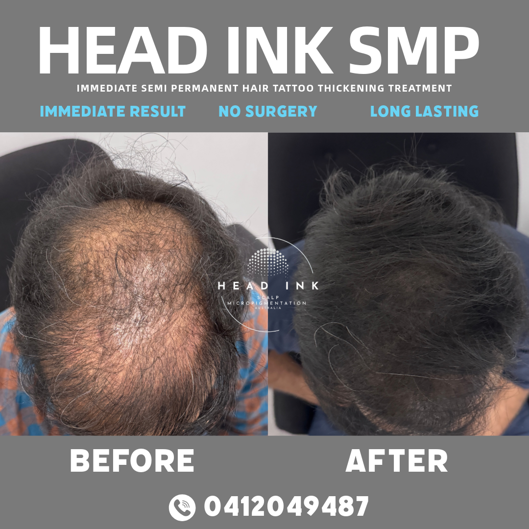 Head Ink SMP Melbourne Facebook ad