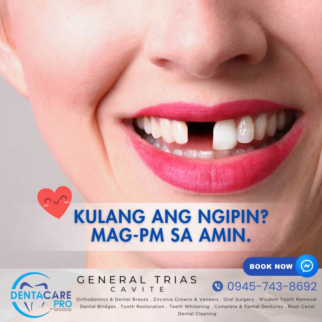DentaCare PRO - General Trias Cavite Facebook ad: Chat in Messenger