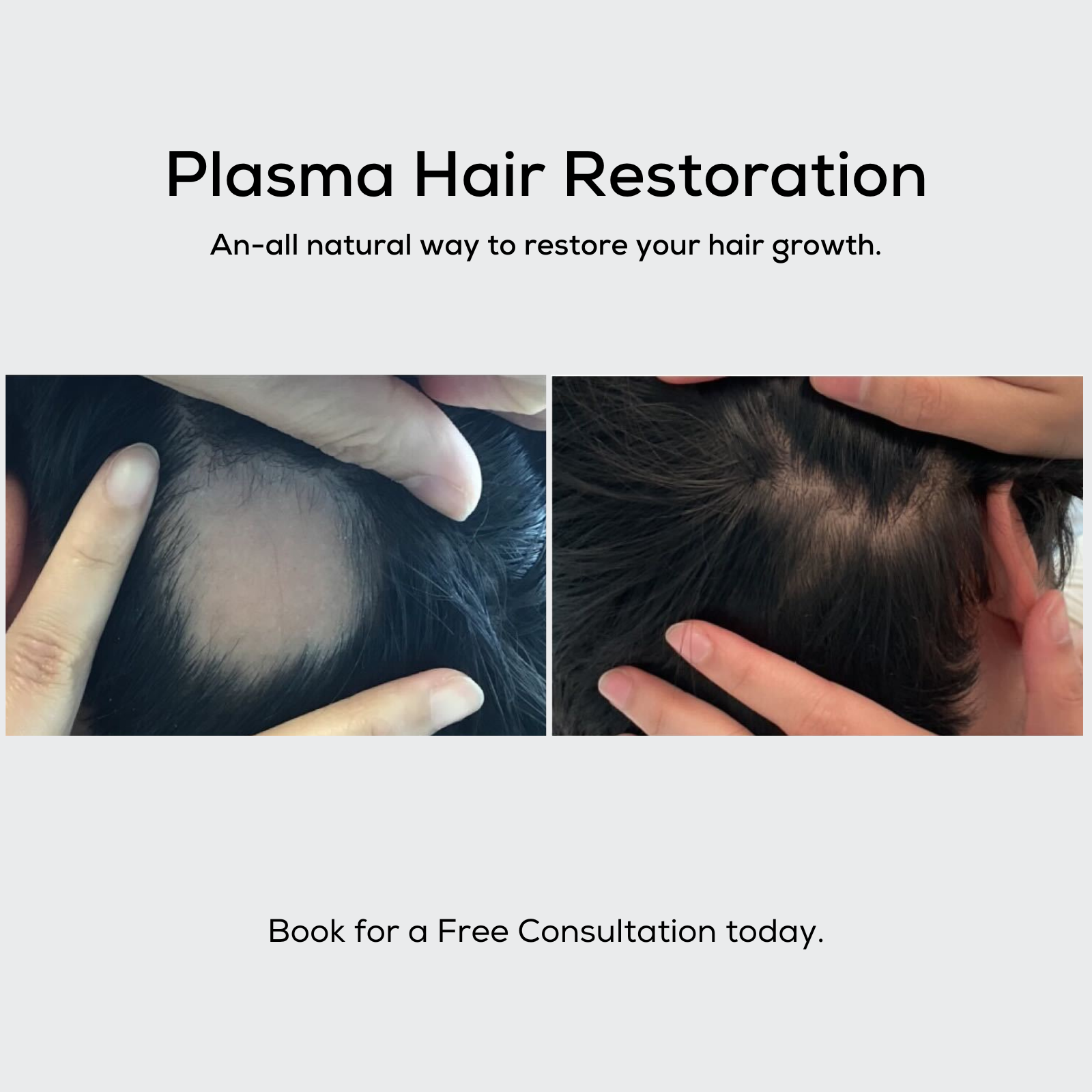Advanced Dermatology Facebook ad: Revive & Regrow Hair, Save 45%